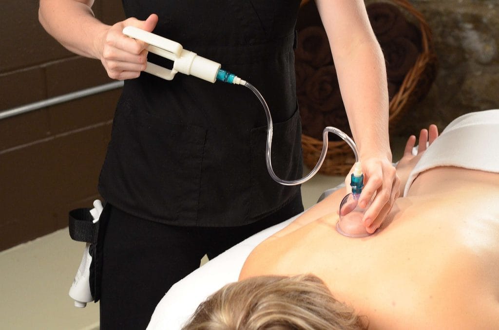 cupping, massage cupping, cup-2852483.jpg